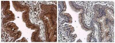 Immunohistochemistry-Paraffin: TOR/mTOR [p Ser2448] Antibody [NBP3-13144]
